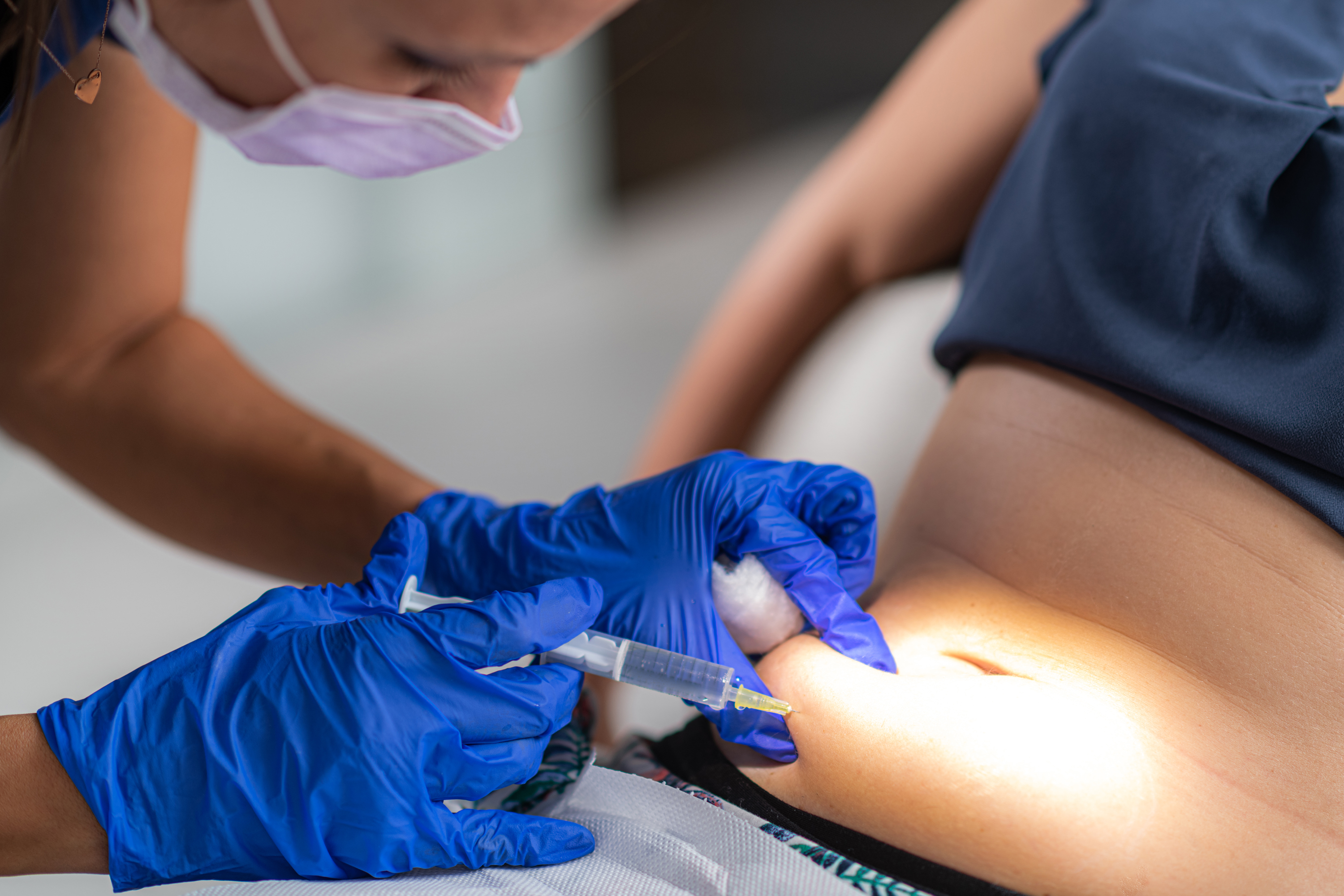 How are Subcutaneous Injections Delivered?