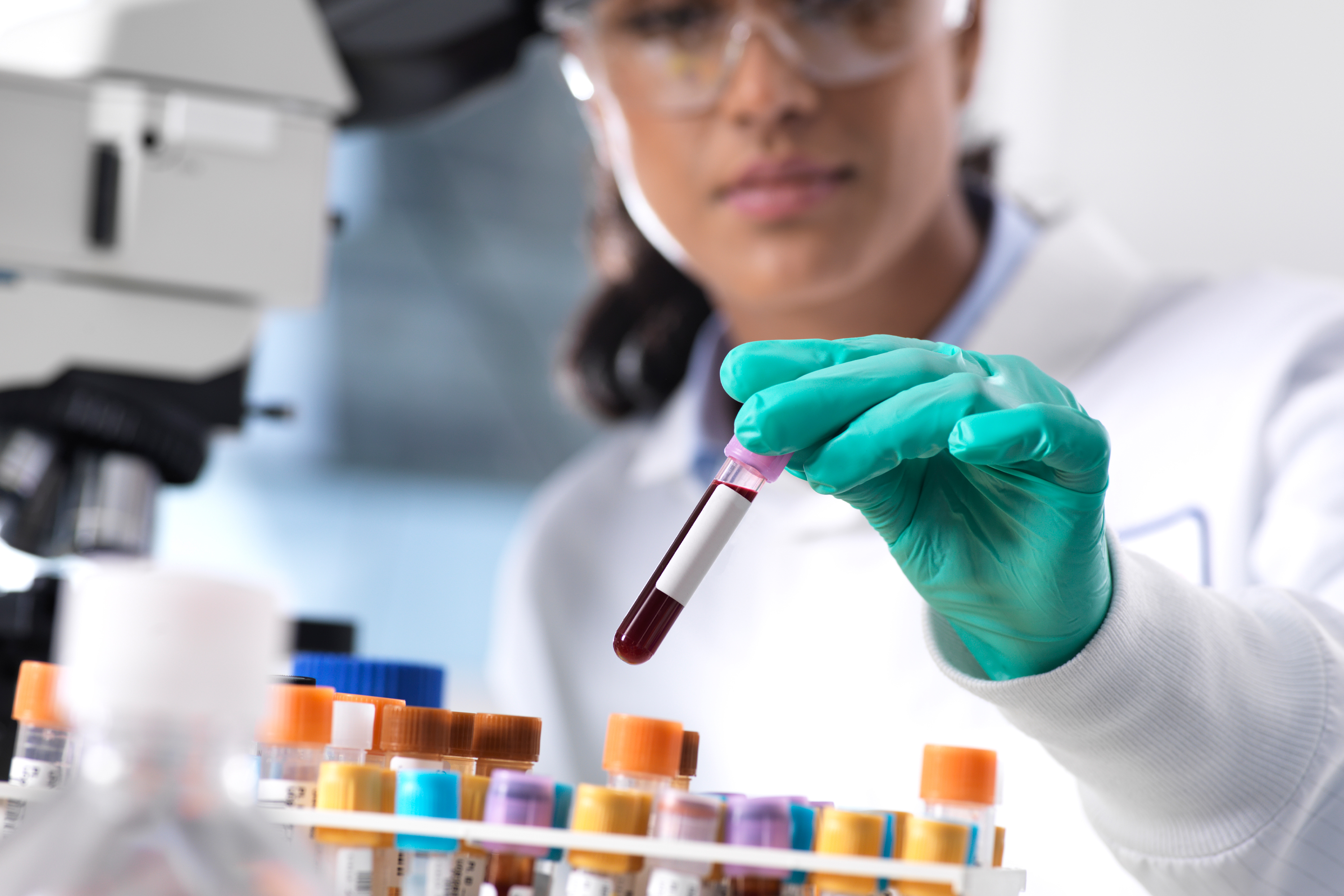 Multiple Myeloma Diagnosis: Which Tests Are Used?