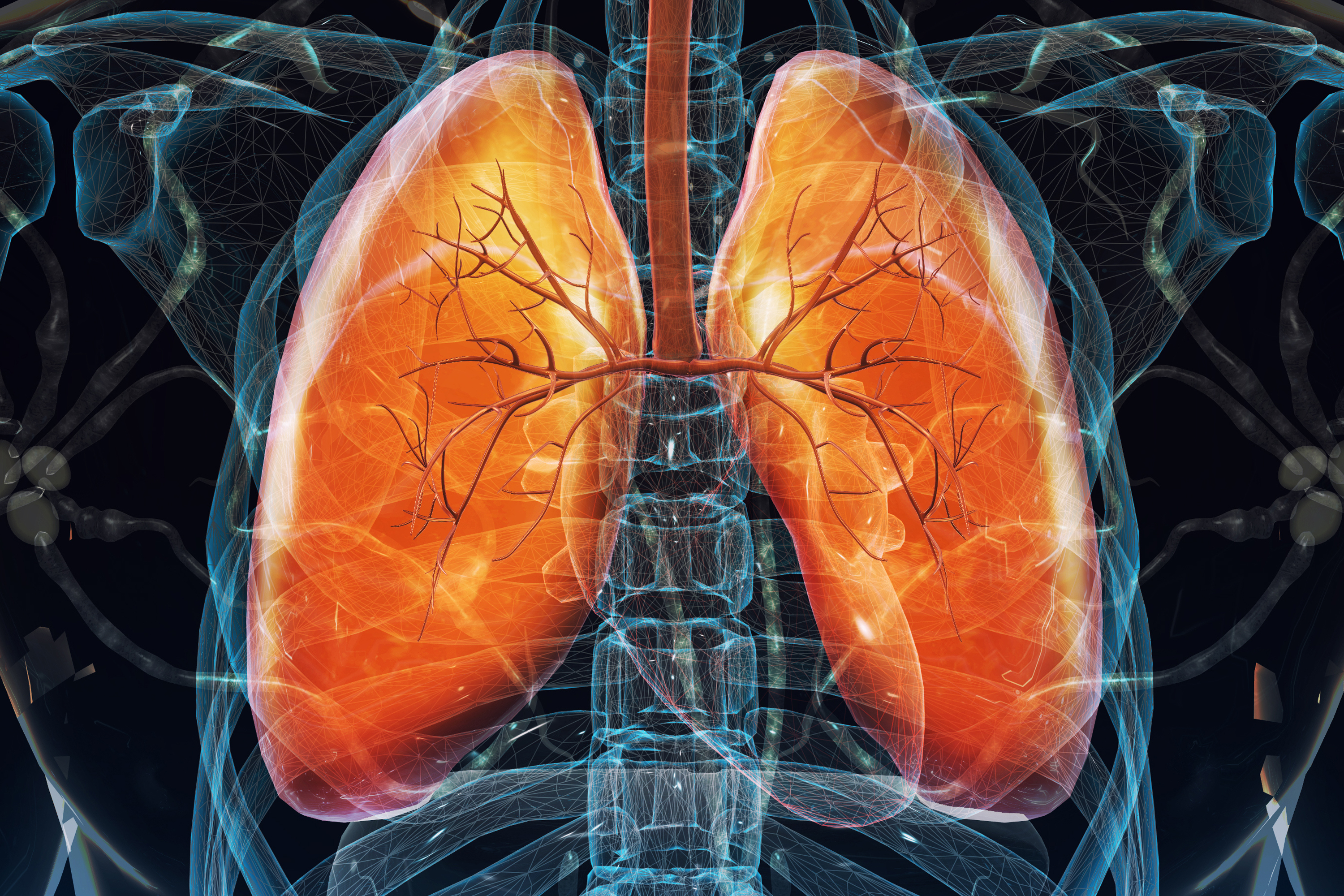 Lung Cancer Stages: Diagnosis and Treatments