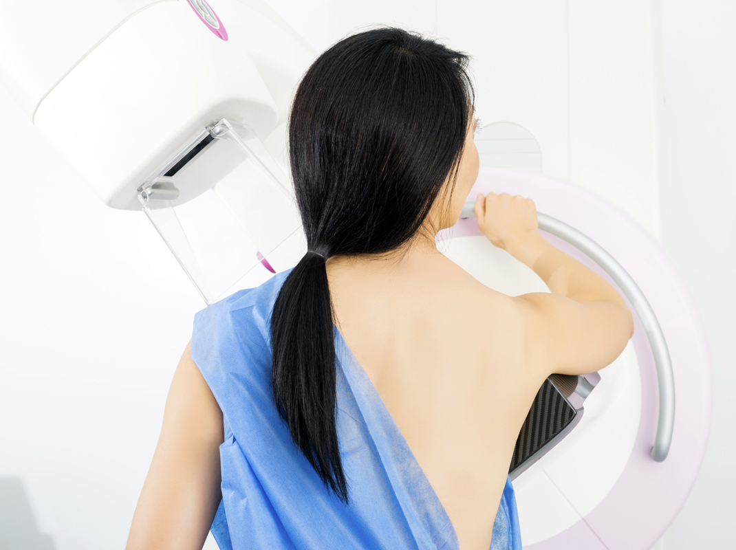 Delaying Mammograms During COVID-19 Means Women Must Know Their