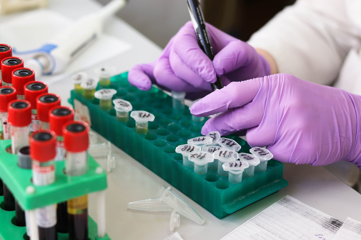 How Do MRD Results Guide Myeloma Care Decisions?