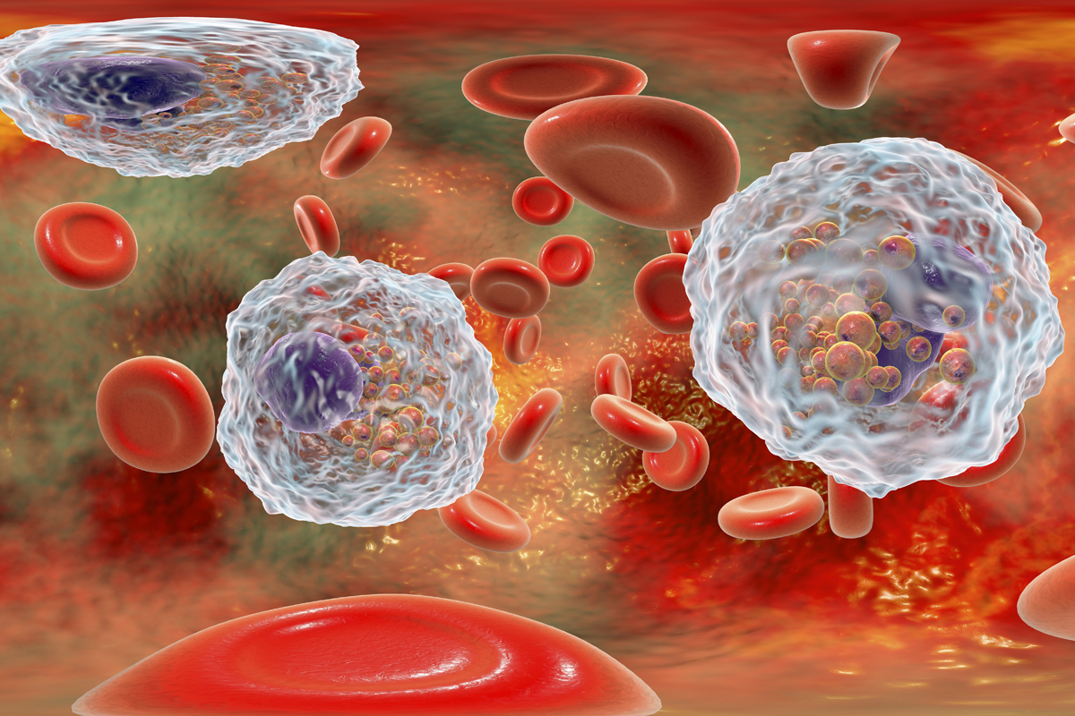 eosinophils-basophils-and-monocytes-what-do-these-lab-results-mean