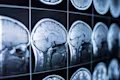 Brain scans