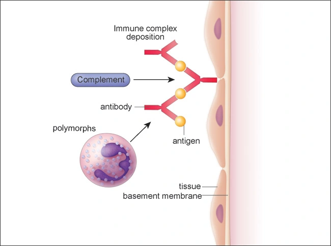 ce537 - Content - Immune-mediated Mechanisms of ADRs - Figure 3