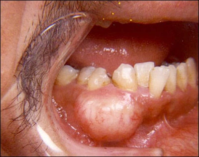 Case Challenge 47 - Content - Select Diagnosis - Figure 1