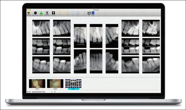 Digital Imaging Basics - Digital Imaging in Dentistry: Intraoral ...