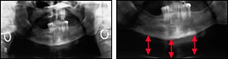 ce589 - Content - Incorrect Head Orientation - Figure 8