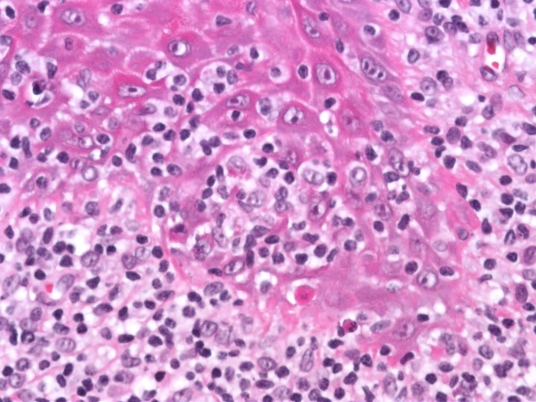 Case Challenge 56 - Content - Diagnostic Information - Figure 3