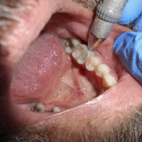 A Clinician’s Guide to Clinical Endodontics
