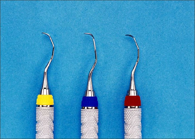 15/16 and 17/18 Gracey Curettes - Advanced Instrumentation for the ...