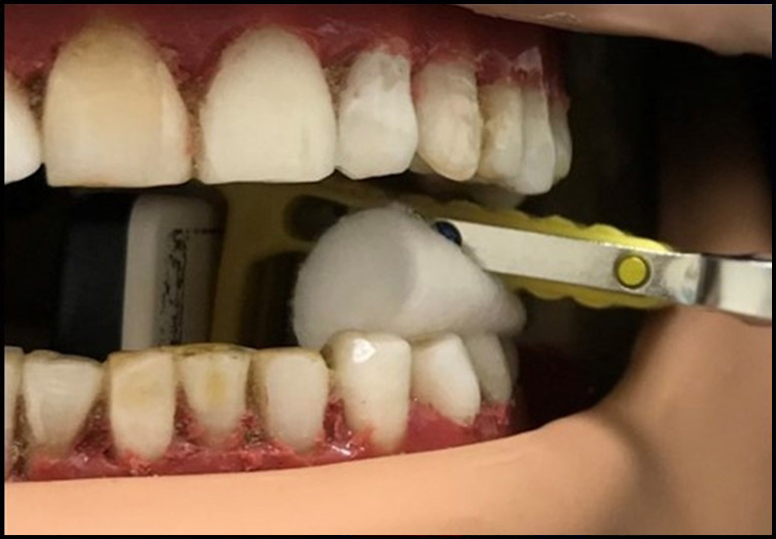 Problem #6: Not Imaging The Entire Tooth | Intraoral Imaging Techniques ...