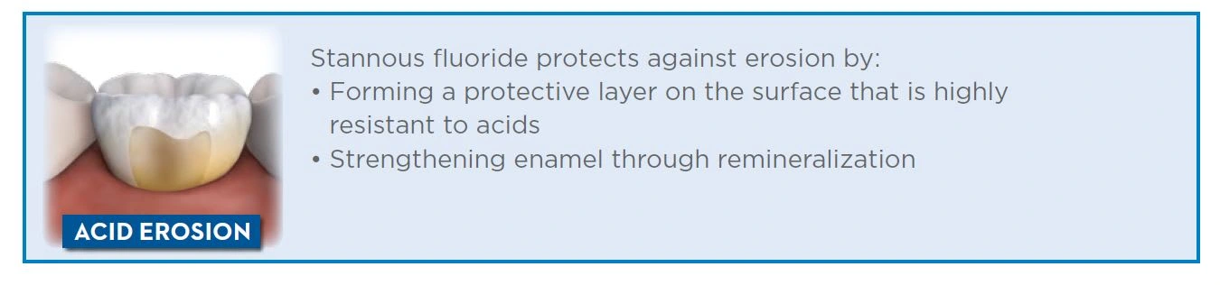 Stannous fluoride protects against erosion