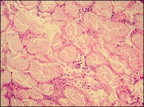 fig04-photomicrograph-med