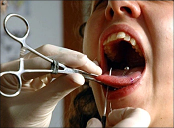 Image: Tongue being pierced with needle.