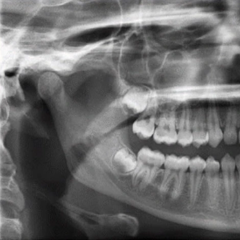 Radiographic Selection Criteria (ce584) - introduction