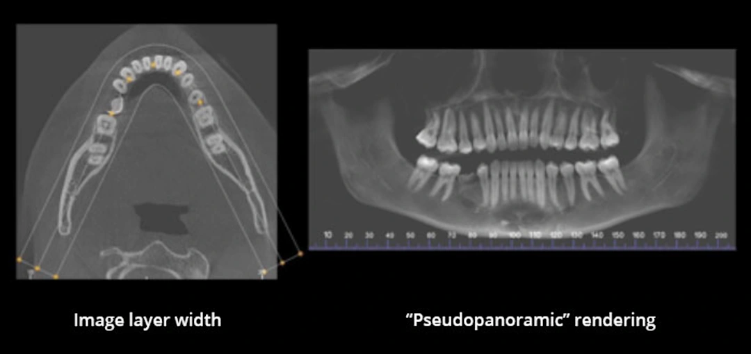 Image Acquisition and Reconstruction - Cone-Beam Computed Tomography ...