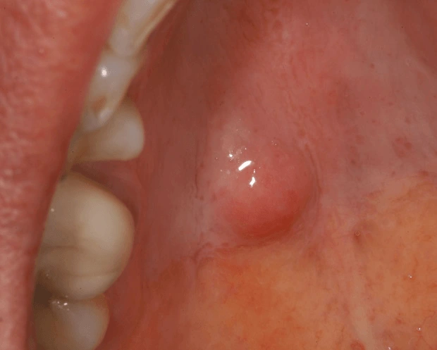 Case Challenge 76 - Content - Select Diagnosis - Figure 1