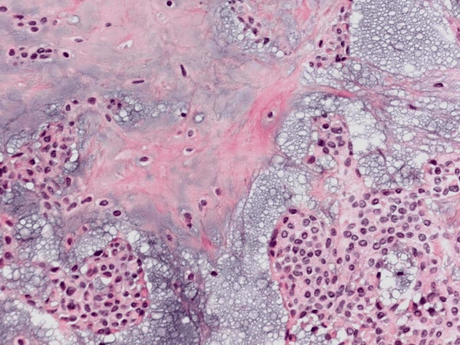 Case Challenge 76 - Content - Diagnostic Information - Figure 4