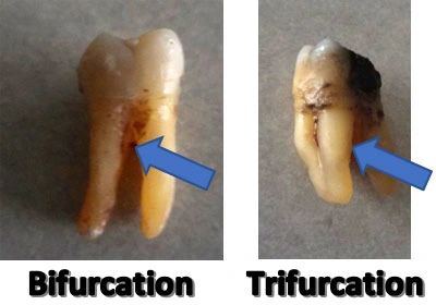 img17-bifurcation