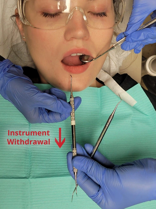 The Singlehanded Transfer The Concepts of Fourhanded Dentistry