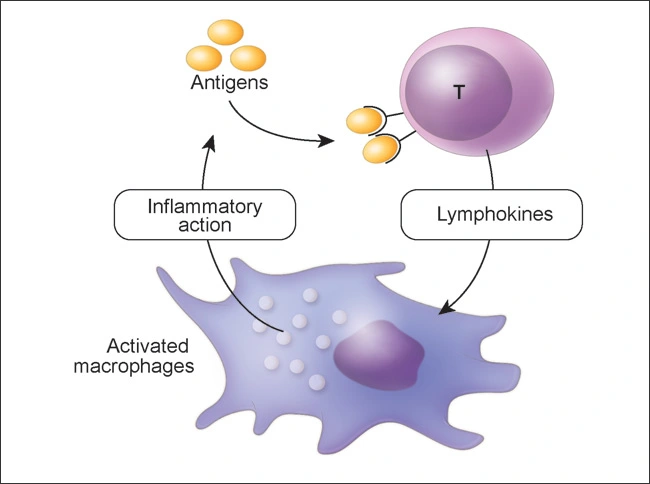 Immune-mediated Mechanisms of ADRs - Adverse Drug Reactions - Part II ...