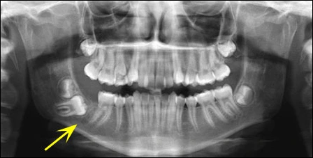 Case Challenge 44 - Content - Diagnostic Information - Figure 1