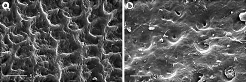 Images showing Tooth surfaces after an acid challenge.