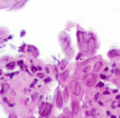 Case Challenge 57 - Content - Diagnostic Information - Figure 2