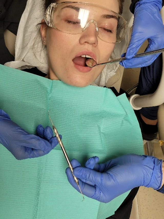 The Singlehanded Transfer The Concepts of Fourhanded Dentistry