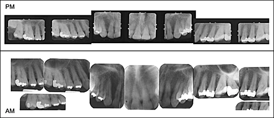 Comparison of Post-mortem (PM) with Ante-mortem (AM) Radiographs.