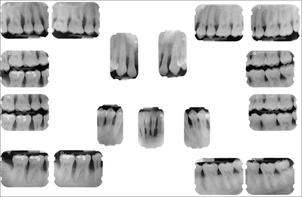 Photo showing radiographs.