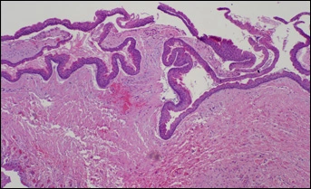 fig03-photomicrograph-40x