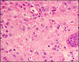 fig05-photomicrograph-high