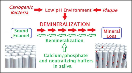 Process diagram for the Demineralization process