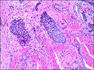 Case Challenge 34 - Content - Diagnostic Information - Figure 6