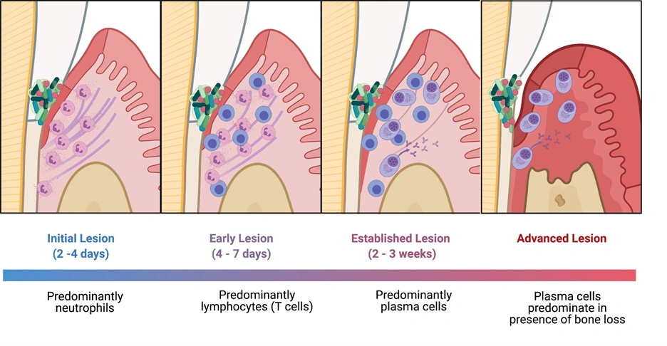Image: Diagram of the process of activation results in proliferation and differentiation into Ig producing Plasma Cells.