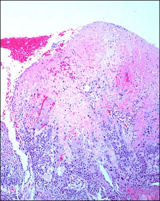 Case Challenge 34 - Content - Diagnostic Information - Figure 3