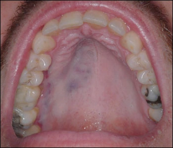 Case Challenge 52 - Content - Select Diagnosis