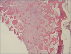 fig04-photomicrograph-low