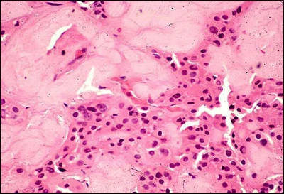 Case Challenge 47 - Content - Diagnostic Information - Figure 5