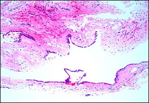 Case Challenge 28 - Content - Diagnostic Information - fig03-photomicrograph-low