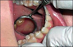 ce337 - Content - Mandible - Figure 1