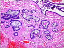 fig15-stellate-reticulum