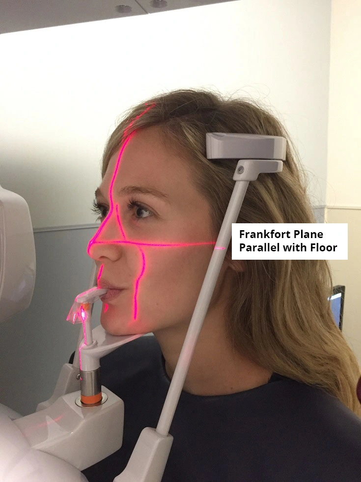 Patient Positioning Panoramic Radiographs Technique & Anatomy Review Dentalcare