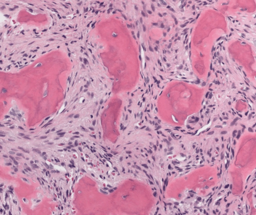 Case Challenge 73 - Content - Diagnostic Information - Figure 3