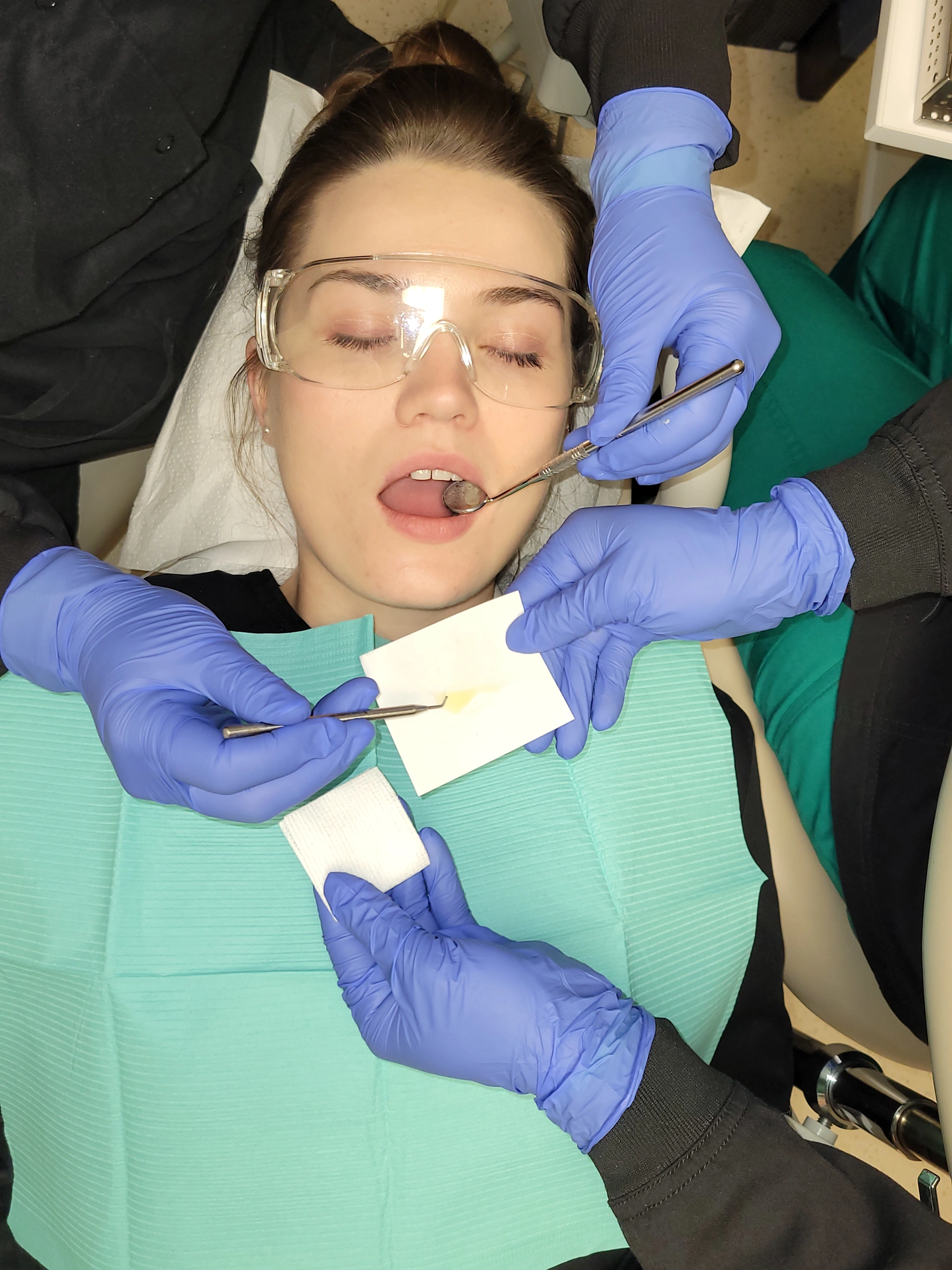 Delivery of Small Items The Concepts of Fourhanded Dentistry