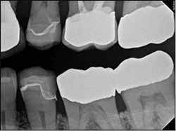 ce468 fig01 various restorative