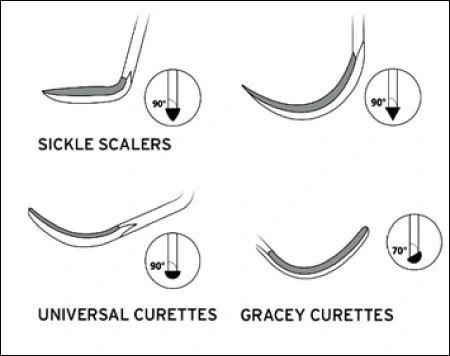 Scalers & Curettes