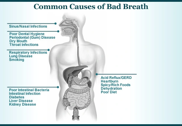 common cause of bad breath