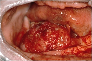 ce348 - Content - Clinical Appearance - Figure 3